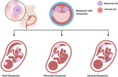 Advancements of non-invasive prenatal testing: the role of obstetricians